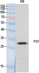 p27 Polyclonal Antibody