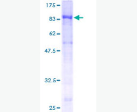 Recombinant Human ICOS/CRP-1/AILIM/CD278