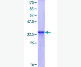 Recombinant Human Ephrin A Receptor 1/EphA1