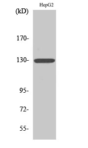 IL-3Rβ Polyclonal Antibody