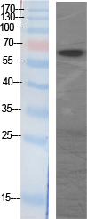 GAD-65/67 Polyclonal Antibody