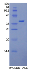 Tissue Factor (TF)