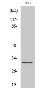 Ribosomal Protein S2 Polyclonal Antibody