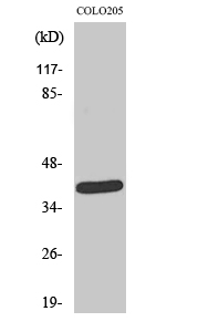 NEGR1 Polyclonal Antibody