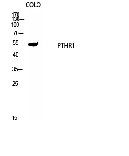 PTH/PTHrP-R Polyclonal Antibody