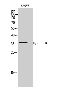 Ephrin-B3 Polyclonal Antibody