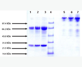 Recombinant Human Poliovirus Receptor/PVR/CD155