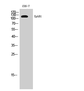 EphB1 Polyclonal Antibody