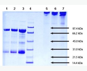 Recombinant Human Sterol O-Acyltransferase 2/SOAT2/ACAT2