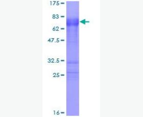 Recombinant Mouse Adiponectin/Acrp30/AdipoQ