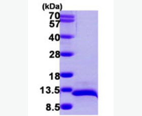 Recombinant Human Fibroblast Growth Factor 17/FGF-17