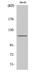 PKD1 Polyclonal Antibody