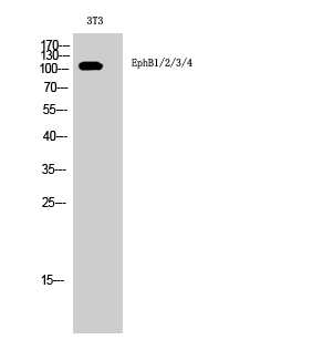 EphB1/2/3/4 Polyclonal Antibody