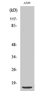 PTH Polyclonal Antibody