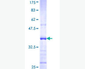 Recombinant Human Fibroblast Growth Factor 17/FGF-17