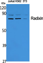 Radixin Polyclonal Antibody