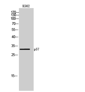 p57 Polyclonal Antibody