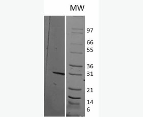 Recombinant Human Fructose-Bisphosphate Aldolase C/ALDOC