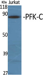 PFK-C Polyclonal Antibody