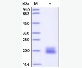 Recombinant Mouse T Cell Immunoglobulin and Mucin Domain-3/TIM-3/HAVCR2