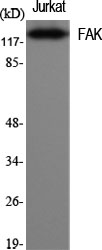 FAK Polyclonal Antibody