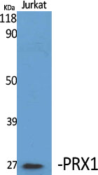 PRX1 Polyclonal Antibody