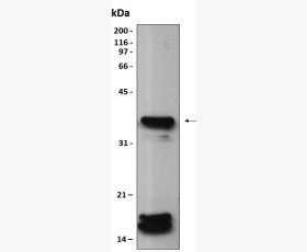 Recombinant Human Triggering Receptor Expressed On Myeloid 2/TREM-2