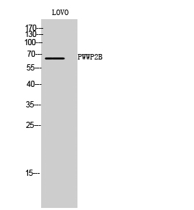 PWWP2B Polyclonal Antibody