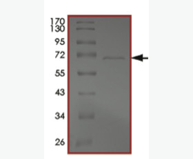 Recombinant Human Ezrin/EZR/VIL2