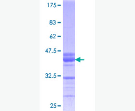 Recombinant Human Activin Receptor 2A/Activin RIIA/ACVR2A