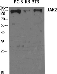 JAK2 Polyclonal Antibody