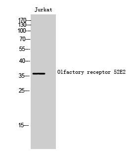 Olfactory receptor 52E2 Polyclonal Antibody