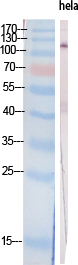 PI 3-kinase p110α Polyclonal Antibody