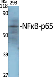 NFκB-p65 Polyclonal Antibody