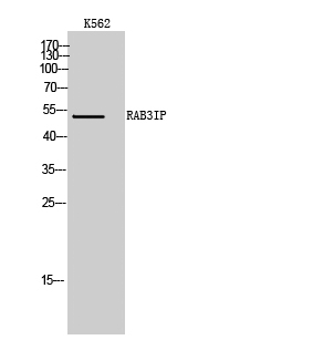 RAB3IP Polyclonal Antibody