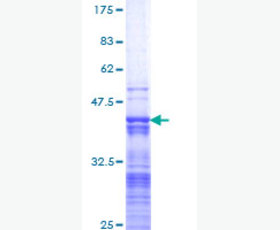 Recombinant Human δ(3,5)-δ(2,4)-Dienoyl-CoA Isomerase, Mitochondrial/ECH1