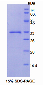 Recombinant Tissue Factor (TF)