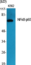 NFκB-p65 Polyclonal Antibody