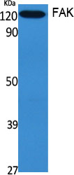 FAK Polyclonal Antibody