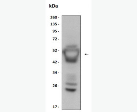 Recombinant Human Aldo-Keto Reductase 1C3/AKR1C3