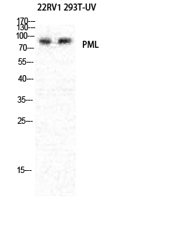 PML Polyclonal Antibody