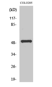 PPP4R1L Polyclonal Antibody