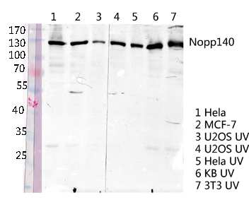 Nopp140 Polyclonal Antibody