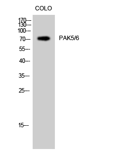 PAK5/6 Polyclonal Antibody