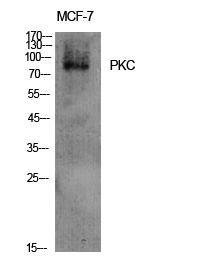 PKC Polyclonal Antibody