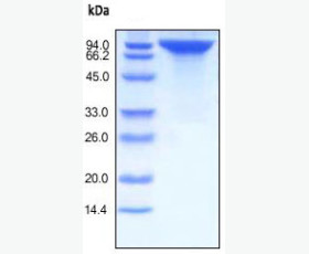 Recombinant Human C-C Motif Chemokine 11/CCL11/Eotaxin