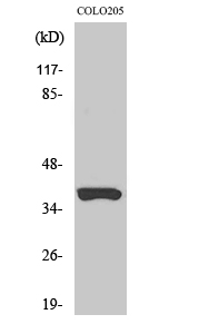 Olfactory receptor 52B2 Polyclonal Antibody