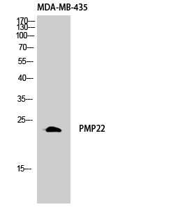 GAS3 Polyclonal Antibody