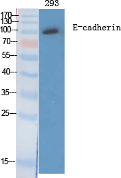 E-cadherin Polyclonal Antibody
