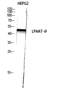 LPAAT-θ Polyclonal Antibody